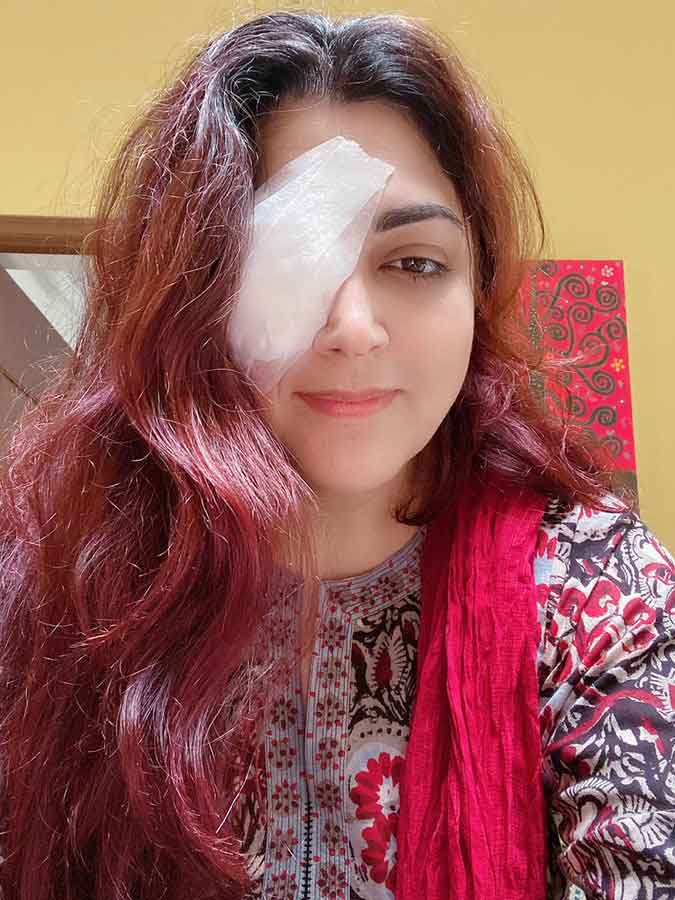kushbu eye got injured